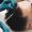Close-up.Young man receiving hair treatment in a beauty salon. Man having mesotherapy session in aesthetic clinic, therapist hands in gloves making scalp injection.